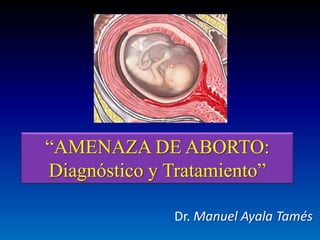 “AMENAZA DE ABORTO:
Diagnóstico y Tratamiento”
Dr. Manuel Ayala Tamés
 
