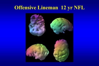 Offensive Lineman 12 yr NFL
 