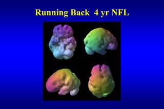 Running Back 4 yr NFL
 