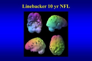 Linebacker 10 yr NFL
 