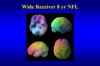 Wide Receiver 8 yr NFL
 