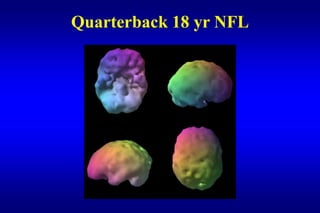 Quarterback 18 yr NFL
 