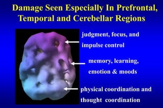 Damage Seen Especially In Prefrontal,
 Temporal and Cerebellar Regions
                 judgment, focus, and
                 impulse control

                   memory, learning,
                   emotion & moods

                 physical coordination and
                 thought coordination
 