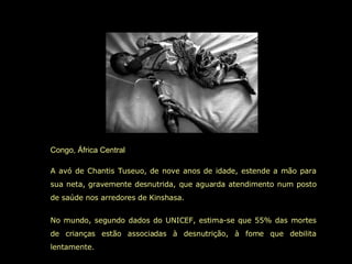 Congo, África Central A avó de Chantis Tuseuo, de nove anos de idade, estende a mão para sua neta,  gravemente desnutrida,  que aguarda atendimento num posto de saúde nos arredores de Kinshasa.  No mundo, segundo dados do UNICEF, estima-se que 55% das mortes de crianças estão associadas à desnutrição, à fome que debilita lentamente.  