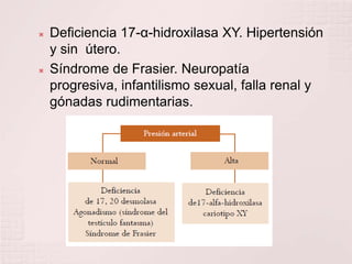 Deficiencia 17-α-hidroxilasa XY. Hipertensión y sin  útero.Síndrome de Frasier. Neuropatía progresiva, infantilismo sexual, falla renal y gónadas rudimentarias.