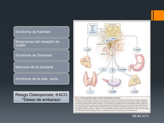 Síndrome de Kallman
Mutaciones del receptor de
GnRH
Síndrome de Sheehan
Necrosis de la pituitaria
Síndrome de la silla vacia
Riesgo Osteoporosis ACO
*Deseo de embarazo
NEJM 2010
 