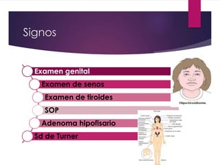 Signos
Examen genital
Examen de senos
Examen de tiroides
SOP
Adenoma hipofisario
Sd de Turner
 