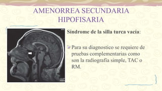 AMENORREA SECUNDARIA
HIPOFISARIA
Síndrome de la silla turca vacía:
Para su diagnostico se requiere de
pruebas complementarias como
son la radiografía simple, TAC o
RM.
 