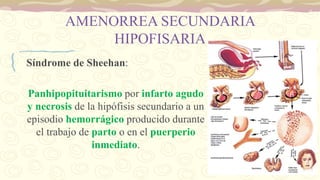AMENORREA SECUNDARIA
HIPOFISARIA
Síndrome de Sheehan:
Panhipopituitarismo por infarto agudo
y necrosis de la hipófisis secundario a un
episodio hemorrágico producido durante
el trabajo de parto o en el puerperio
inmediato.
 