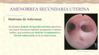 AMENORREA SECUNDARIA UTERINA
Síndrome de Asherman:
Se produce después de legrados uterinos agresivos,
con mayor frecuencia legrados puerperales o abortos
tardíos, que terminan por destruir el endometrio y
formar adherencias en la cavidad uterina
 