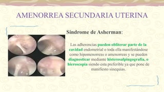 AMENORREA SECUNDARIA UTERINA
Síndrome de Asherman:
Las adherencias pueden obliterar parte de la
cavidad endometrial o toda ella manifestándose
como hipomenorreas o amenorreas y se pueden
diagnosticar mediante histerosalpingografía, o
hieroscopia siendo esta preferible ya que pone de
manifiesto sinequias.
 