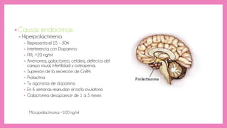 •Causas endocrinas:
• Hiperprolactimenia
• Representa el 15 – 30%
• Interferencia con Dopamina
• PRL >20 ng/ml
• Amenorrea, galactorrea, cefalea, defectos del
campo visual, infertilidad y osteopenia.
• Supresión de la secreción de GnRH.
• Prolactina
• Tx: agonistas de dopamina
• En 6 semanas reanudan el ciclo ovulatorio
• Galactorrea desaparece de 1 a 3 meses
Microprolactinoma: <100 ng/ml
 