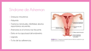 Síndrome de Asherman
• Sinequias intrauterinas
• Adquirido
• Trastornos menstruales, infertilidad, abortos
espontáneos recurrentes.
• Amenorrea es el síntoma mas frecuente.
• Daño en la capa basal del endometrio.
• Legrado.
• Tx: lisis de las adherencias.
 