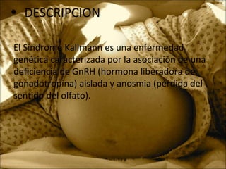 • DESCRIPCION
El Síndrome Kallmann es una enfermedad
genética caracterizada por la asociación de una
deficiencia de GnRH (hormona liberadora de
gonadotropina) aislada y anosmia (pérdida del
sentido del olfato).
 