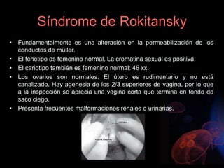 Síndrome de Rokitansky
• Fundamentalmente es una alteración en la permeabilización de los
conductos de müller.
• El fenotipo es femenino normal. La cromatina sexual es positiva.
• El cariotipo también es femenino normal: 46 xx.
• Los ovarios son normales. El útero es rudimentario y no está
canalizado. Hay agenesia de los 2/3 superiores de vagina, por lo que
a la inspección se aprecia una vagina corta que termina en fondo de
saco ciego.
• Presenta frecuentes malformaciones renales o urinarias.
 