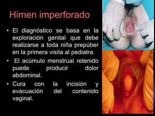 Himen imperforado
• El diagnóstico se basa en la
exploración genital que debe
realizarse a toda niña prepúber
en la primera visita al pediatra.
• El acúmulo menstrual retenido
puede producir dolor
abdominal.
• Cura con la incisión y
evacuación del contenido
vaginal.
 