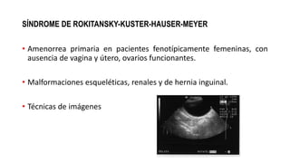 SÍNDROME DE ROKITANSKY-KUSTER-HAUSER-MEYER
• Amenorrea primaria en pacientes fenotípicamente femeninas, con
ausencia de vagina y útero, ovarios funcionantes.
• Malformaciones esqueléticas, renales y de hernia inguinal.
• Técnicas de imágenes
 