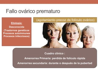 Fallo ovárico prematuro
• (agotamiento precoz de folículo ovárico)
Etiología:
Desconocida
(Trastornos genéticos
Procesos autoinmunes
Procesos infecciosos)
Cuadro clínico :
Amenorrea Primaria: perdida de folículo rápida
Amenorrea secundaria: durante o después de la pubertad
 