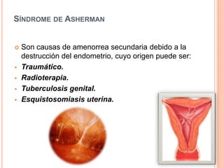 SÍNDROME DE ASHERMAN 
 Son causas de amenorrea secundaria debido a la 
destrucción del endometrio, cuyo origen puede ser: 
 Traumático. 
 Radioterapia. 
 Tuberculosis genital. 
 Esquistosomiasis uterina. 
 
