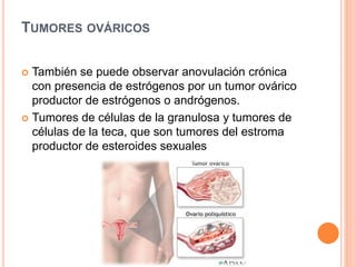 TUMORES OVÁRICOS 
 También se puede observar anovulación crónica 
con presencia de estrógenos por un tumor ovárico 
productor de estrógenos o andrógenos. 
 Tumores de células de la granulosa y tumores de 
células de la teca, que son tumores del estroma 
productor de esteroides sexuales 
 
