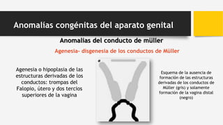 Agenesia- disgenesia de los conductos de Müller
Agenesia o hipoplasia de las
estructuras derivadas de los
conductos: trompas del
Falopio, útero y dos tercios
superiores de la vagina
Esquema de la ausencia de
formación de las estructuras
derivadas de los conductos de
Müller (gris) y solamente
formación de la vagina distal
(negro)
Anomalías congénitas del aparato genital
Anomalias del conducto de müller
 