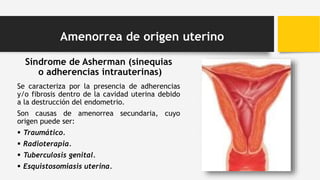 Síndrome de Asherman (sinequias
o adherencias intrauterinas)
Se caracteriza por la presencia de adherencias
y/o fibrosis dentro de la cavidad uterina debido
a la destrucción del endometrio.
Son causas de amenorrea secundaria, cuyo
origen puede ser:
 Traumático.
 Radioterapia.
 Tuberculosis genital.
 Esquistosomiasis uterina.
Amenorrea de origen uterino
 