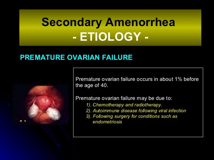 amenorrhea