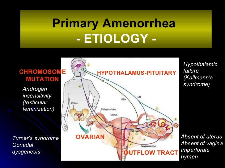 Amenorrhea menstrual pain diagram 