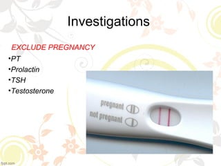 Investigations
EXCLUDE PREGNANCY
•PT
•Prolactin
•TSH
•Testosterone
 