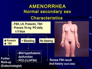 AMENORRHEA
Normal secondary sex
Characteristics
- FSH, LH, Prolactin, TSH
- Provera 10 mg PO daily
x 5 days
+ Bleeding No bleeingProlactin
 TSH
Further
Work-up
(Endocrinologist)
- Mild hypothalamic
dysfunction
- PCO (LH/FSH) Review FSH result
And history (next slide)
 