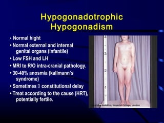 Hypogonadotrophic
Hypogonadism
• Normal hight
• Normal external and internal
genital organs (infantile)
• Low FSH and LH
• MRI to R/O intra-cranial pathology.
• 30-40% anosmia (kallmann’s
syndrome)
• Sometimes  constitutional delay
• Treat according to the cause (HRT),
potentially fertile.
 