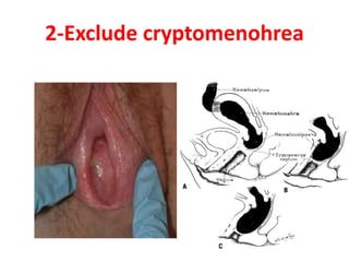 2-Exclude cryptomenohrea
 