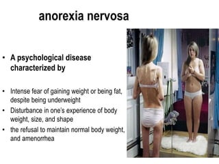 anorexia nervosaa nervosa
• A psychological disease
characterized by
• Intense fear of gaining weight or being fat,
despite being underweight
• Disturbance in one’s experience of body
weight, size, and shape
• the refusal to maintain normal body weight,
and amenorrhea
 