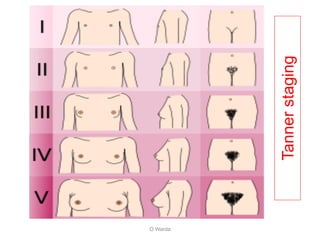 O Warda
Tannerstaging
 