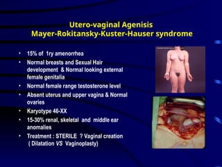 Primary Amenorrhoea in Gynecologyamenorrhea[1].ppt