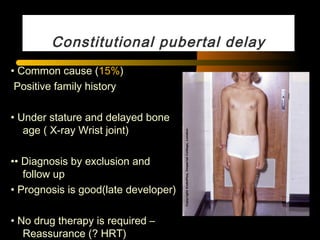 Constitutional pubertal delay
• Common cause (15%)
Positive family history
• Under stature and delayed bone
age ( X-ray Wrist joint)
•• Diagnosis by exclusion and
follow up
• Prognosis is good(late developer)
• No drug therapy is required –
Reassurance (? HRT)
 
