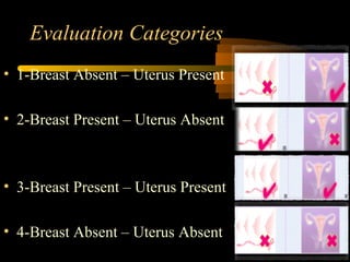 Evaluation Categories
• 1-Breast Absent – Uterus Present
• 2-Breast Present – Uterus Absent
• 3-Breast Present – Uterus Present
• 4-Breast Absent – Uterus Absent
 