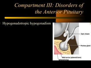 Compartment III: Disorders of
the Anterior Pituitary
• Hypogonadotropic hypogonadism
 
