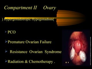 Compartment IICompartment II Ovary
 PCO
Premature Ovarian Failure
 Resistance Ovarian Syndrome
Radiation & Chemotherapy .
)Hypergonadotropic Hypogonadism(
 