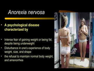 Anorexia Nervosa
Anorexia nervosa
• A psychological disease
characterized by
• Intense fear of gaining weight or being fat,
despite being underweight
• Disturbance in one’s experience of body
weight, size, and shape
• the refusal to maintain normal body weight,
and amenorrhea
 