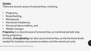 7
Causes:
There are several causes of amenorrhea, including;
• Pregnancy,
• Breastfeeding,
• Menopause,
• Hormonal imbalances,
• Structural abnormalities, and
• Weight changes.
Pregnancy is a natural cause of amenorrhea, as menstrual periods stop
during pregnancy.
Similarly, breastfeeding can also cause amenorrhea, as the hormone levels
needed for lactation can prevent ovulation and the menstrual cycle.
 