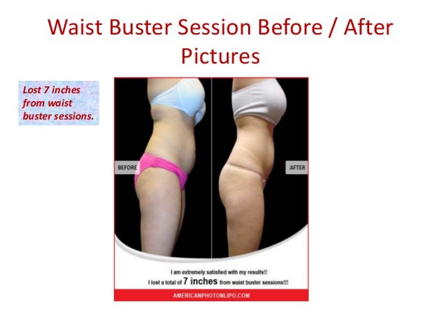 American Photon Lipo Centers Reviews Burr Ridge Il