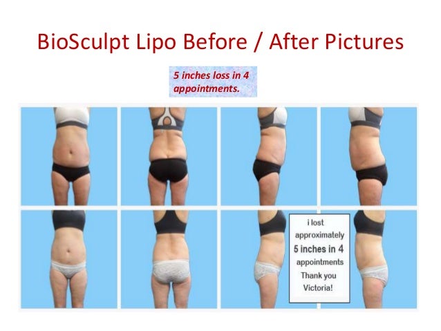 American Photon Lipo Centers Reviews Burr Ridge Il
