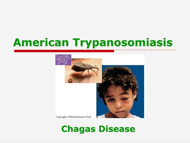 American Trypanosomiasis 2.ppt