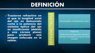 HIPERMETROPIA
Eje del globo es demasiado corto
Poder de
refracción del segmento anterior
(córnea-cristalino) es menor de lo
normal
DEFINICIÓN
 