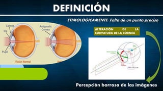 DEFINICIÓN
ETIMOLOGICAMENTE: Falta de un punto preciso
ALTERACIÓN DE LA
CURVATURA DE LA CORNEA
Percepción borrosa de las imágenes
 