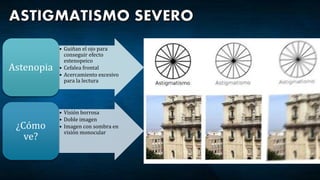 • Guiñan el ojo para
conseguir efecto
estenopeico
• Cefalea frontal
• Acercamiento excesivo
para la lectura
Astenopia
• Visión borrosa
• Doble imagen
• Imagen con sombra en
visión monocular
¿Cómo
ve?
 