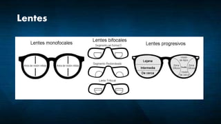 Lentes
 