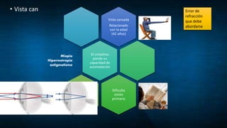 • Vista can
Vista cansada
Relacionado
con la edad
(42 años)
El cristalino
pierde su
capacidad de
acomodación
Miopia
Hipermetropia
astigmatismo
Dificulta
visión
primaria
Error de
refracción
que debe
abordarse
 