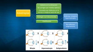 Ametropías
-Defecto en la refracción.
-Se corrigen por medios ópticos.
-Causados por defectos en la
cornea o longitud axial del ojo.
Etiología: aun desconocida.
Clasificación
Esféricas: miopía e
hipermetropía.
No esféricas:
astgmatismo.
 